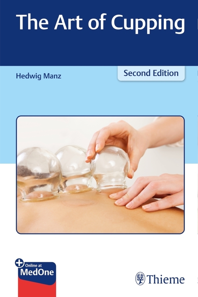 Cover: 9783132431720 | The Art of Cupping | Plus Online at MedOne | Hedwig Manz | Bundle