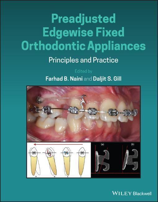 Cover: 9781118817698 | Preadjusted Edgewise Fixed Orthodontic Appliances | Naini (u. a.)