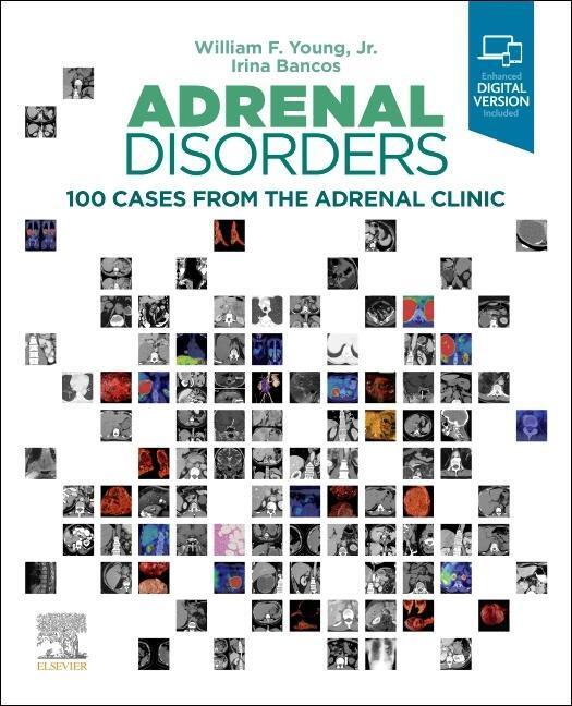 Cover: 9780323792851 | Adrenal Disorders: 100 Cases from the Adrenal Clinic | Young (u. a.)