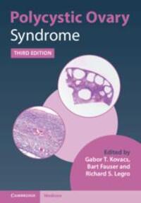 Cover: 9781108839334 | Polycystic Ovary Syndrome | Bart Fauser (u. a.) | Buch | Gebunden