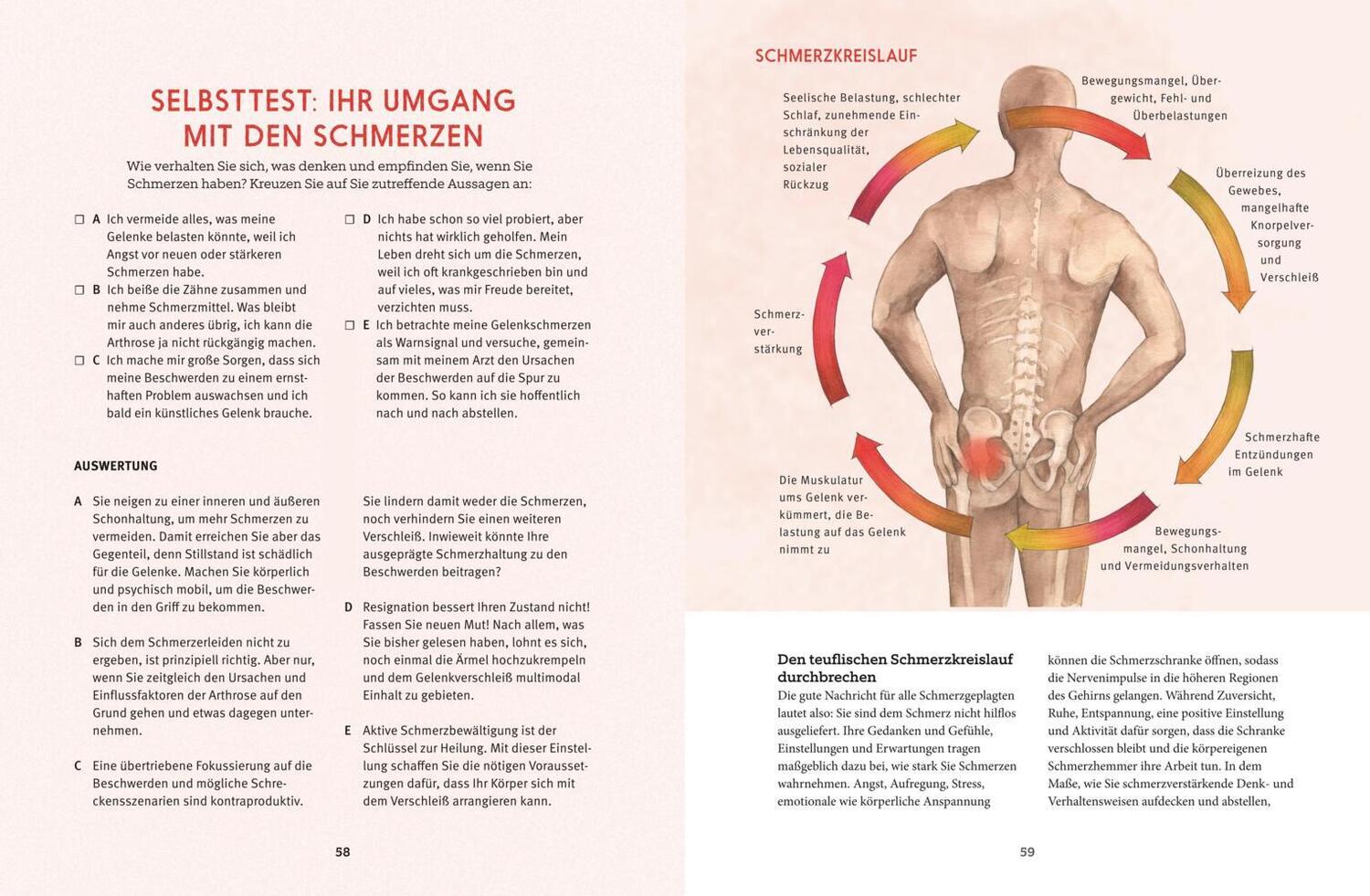 Bild: 9783833859151 | Arthrose selbst heilen | Martin Marianowicz (u. a.) | Taschenbuch