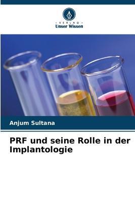 Cover: 9786205842805 | PRF und seine Rolle in der Implantologie | Anjum Sultana | Taschenbuch
