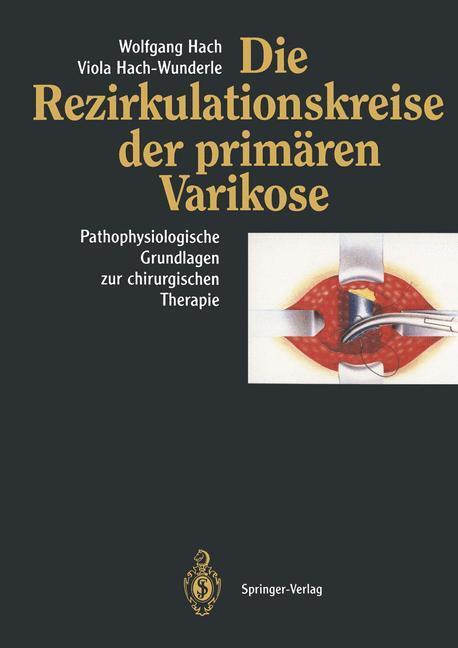 Cover: 9783662008782 | Die Rezirkulationskreise der primären Varikose | Hach-Wunderle (u. a.)