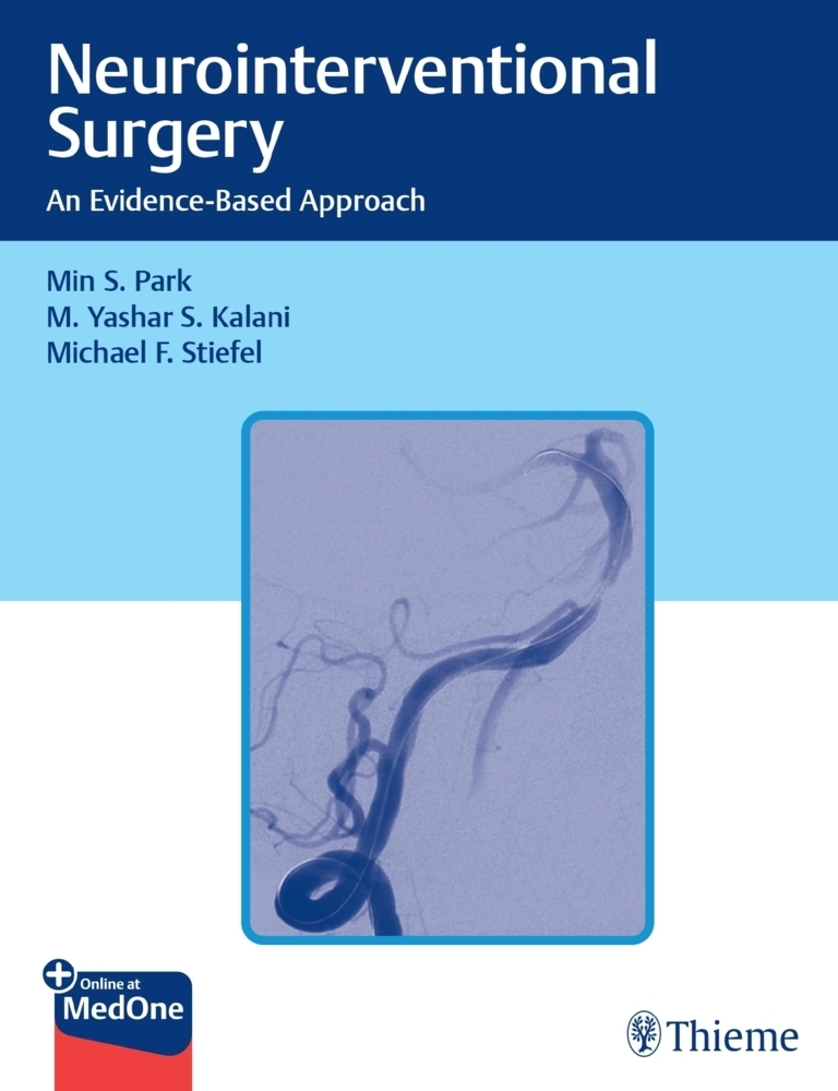 Cover: 9781684200078 | Neurointerventional Surgery | An Evidence-Based Approach | Bundle