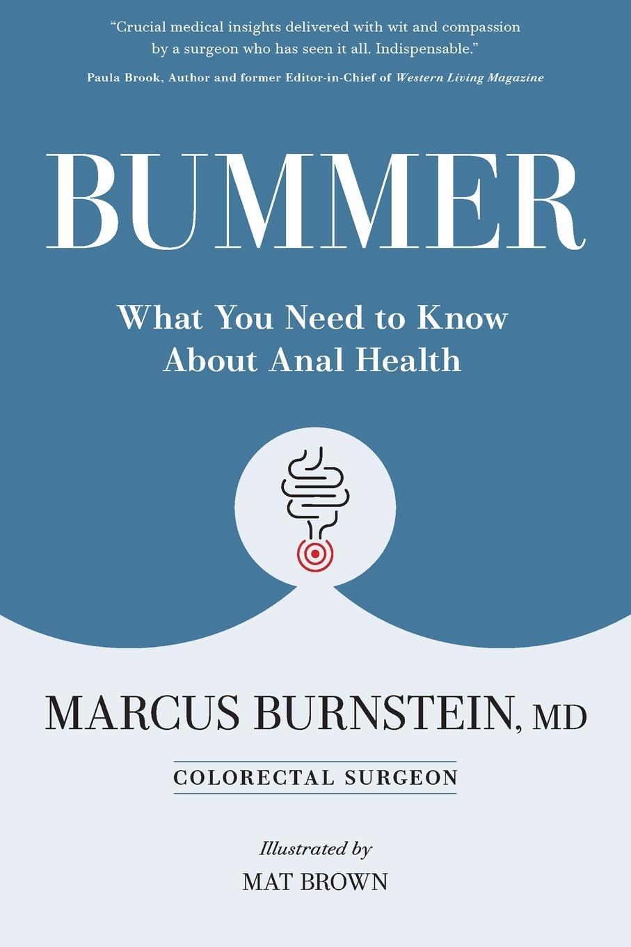 Cover: 9781738109302 | Bummer | What You Need to Know About Anal Health | Marcus Burnstein
