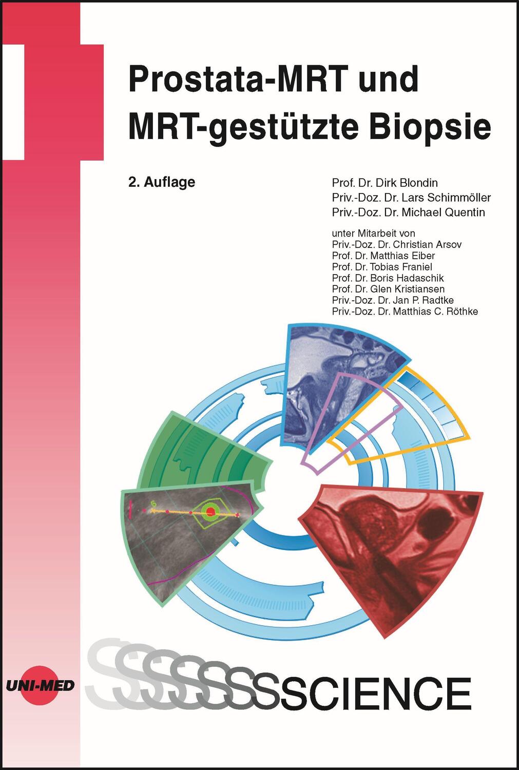 Cover: 9783837415896 | Prostata-MRT und MRT-gestützte Biopsie | Dirk Blondin (u. a.) | Buch