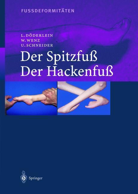 Cover: 9783642622069 | Fussdeformitäten | Der Spitzfuss/Der Hackenfuss | Döderlein (u. a.)