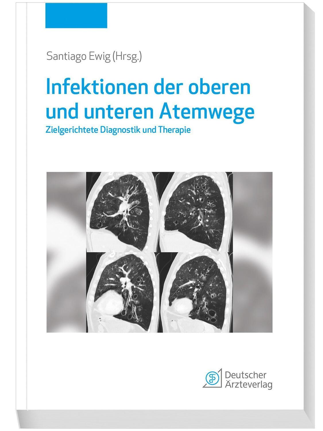 Cover: 9783769137675 | Infektionen der oberen und unteren Atemwege | Diagnostik und Therapie