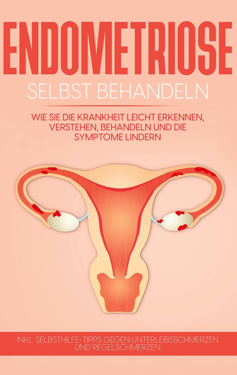 Cover: 9783754309001 | Endometriose selbst behandeln: Wie Sie die Krankheit leicht...