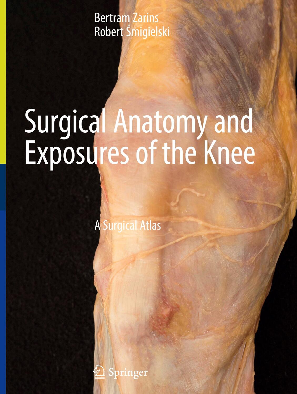 Cover: 9783031476600 | Surgical Anatomy and Exposures of the Knee | A Surgical Atlas | Buch