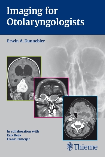 Cover: 9783131463319 | Imaging for Otolaryngologists | Erwin A. Dunnebier | Taschenbuch