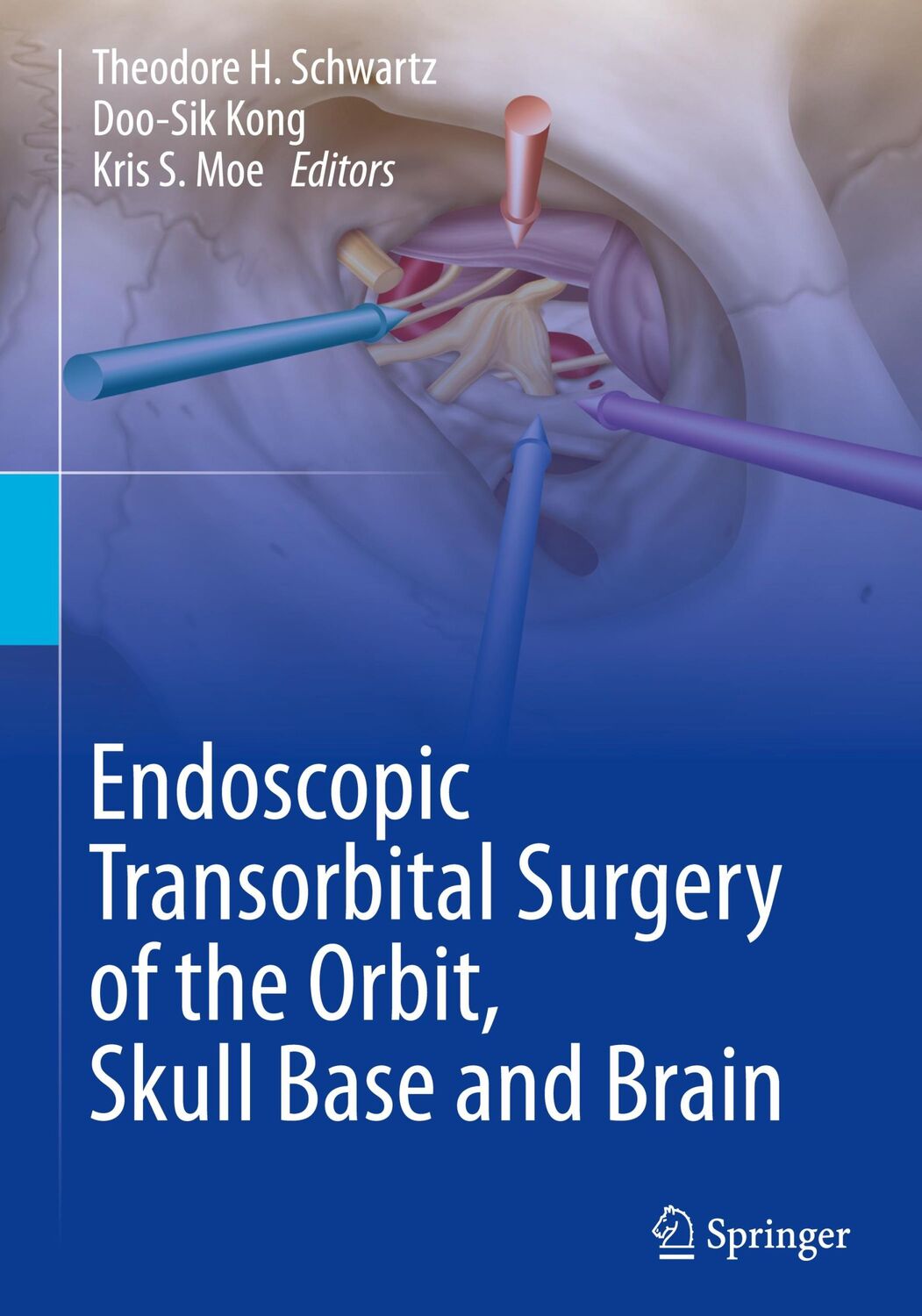 Cover: 9783031595035 | Endoscopic Transorbital Surgery of the Orbit, Skull Base and Brain