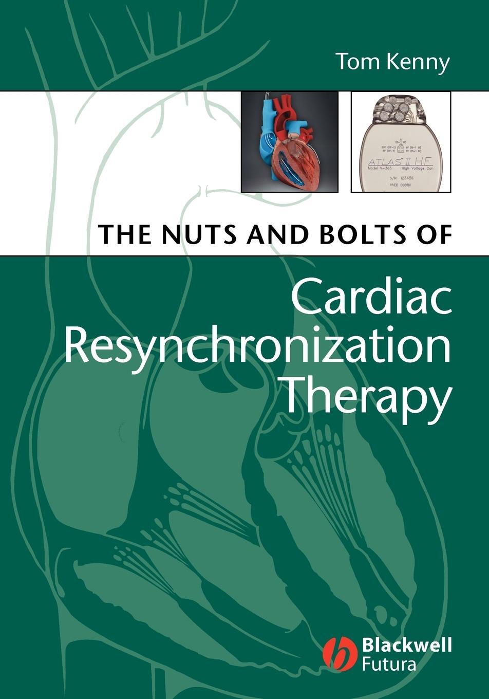 Cover: 9781405153720 | Nuts and Bolts of Cardiac | Kenny | Taschenbuch | Paperback | 226 S.