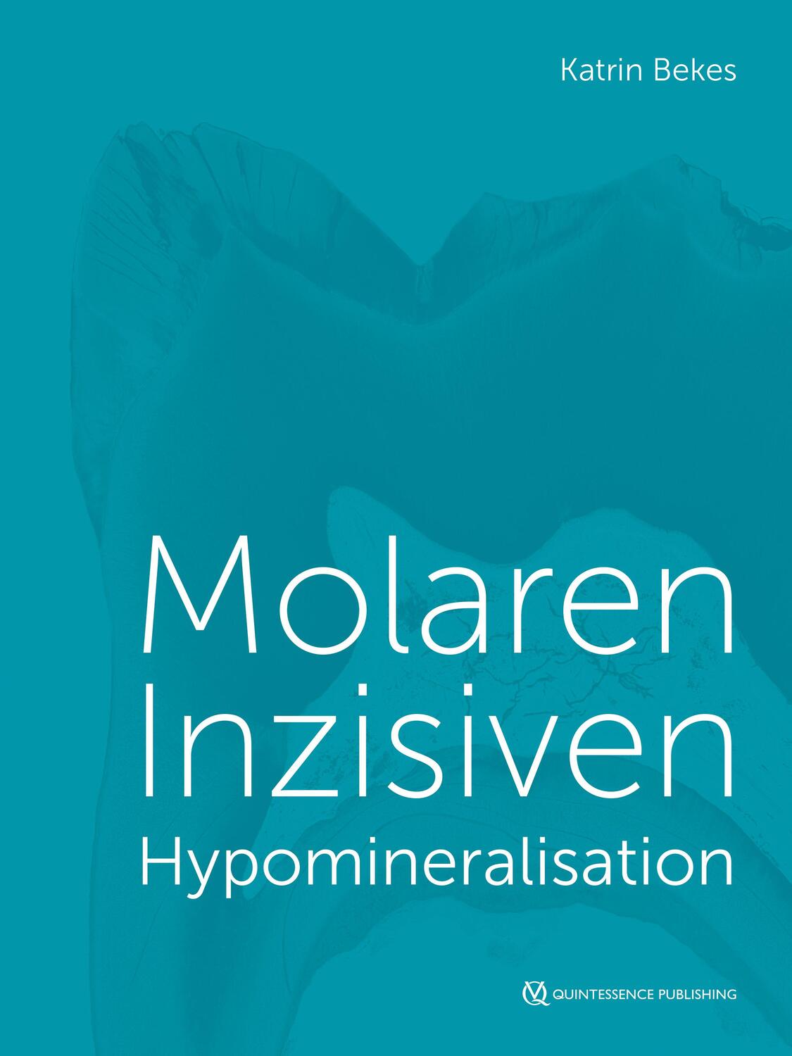 Cover: 9783868675610 | Molaren-Inzisiven-Hypomineralisation | Katrin Bekes | Buch | 188 S.