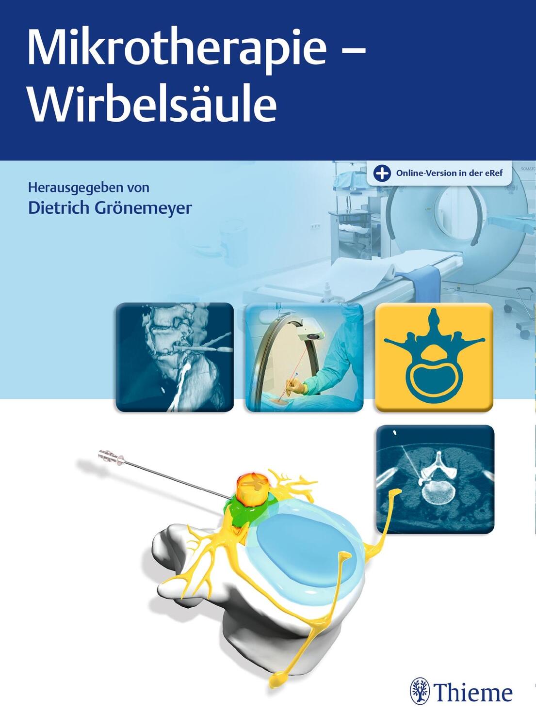 Cover: 9783132416673 | Mikrotherapie - Wirbelsäule | Dietrich H. W. Grönemeyer | Bundle