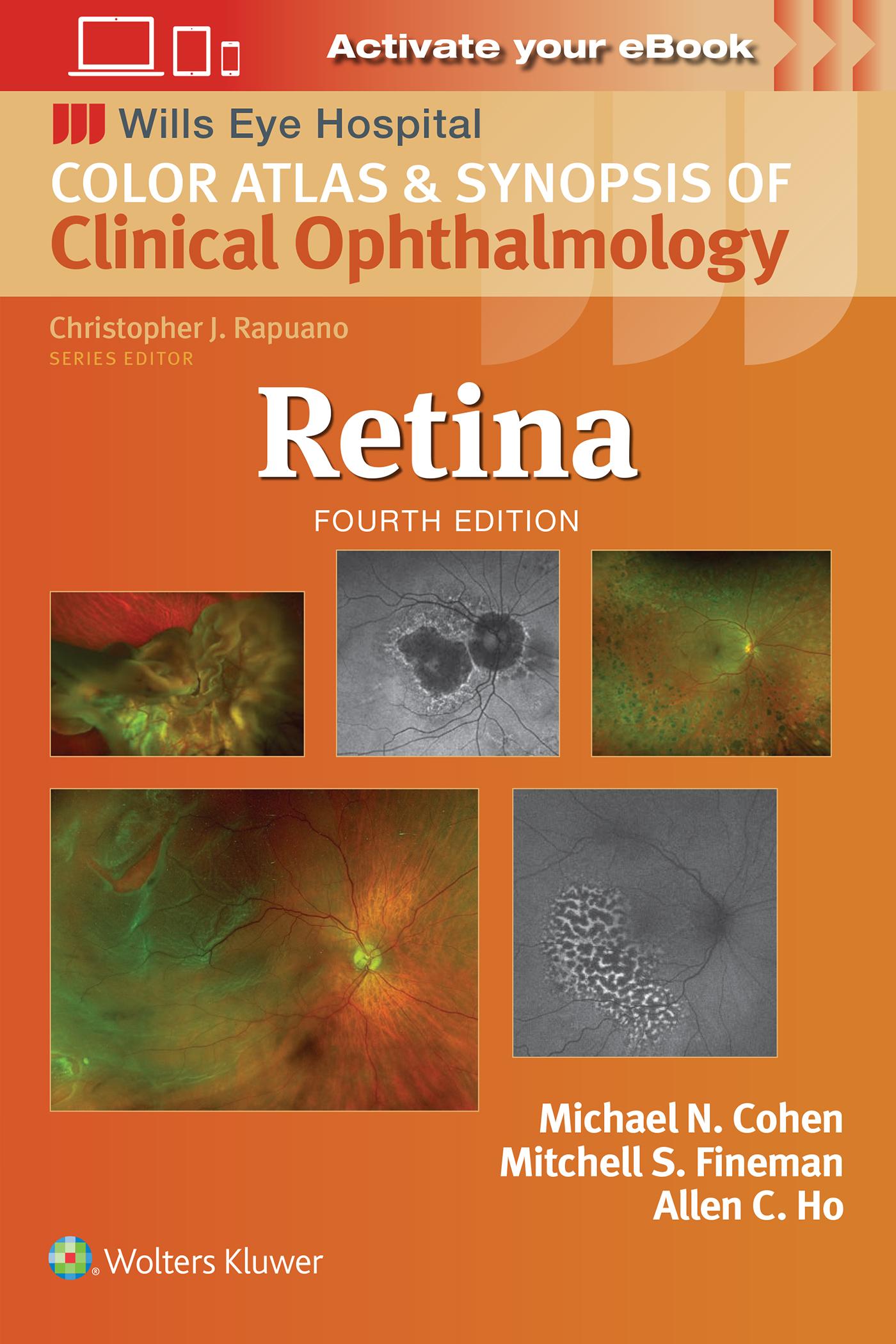 Cover: 9781975215149 | Retina | Mitchell S. Fineman | Taschenbuch | Englisch | 2024