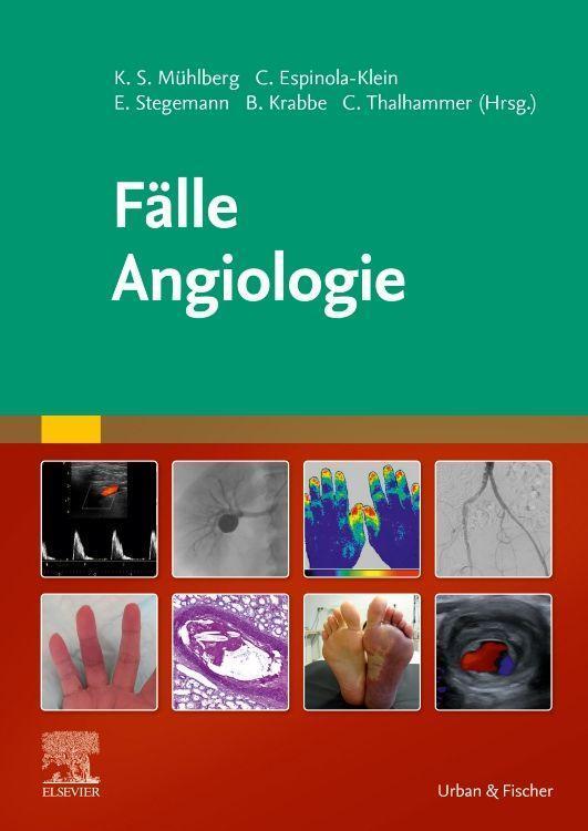 Cover: 9783437232718 | Fälle Angiologie | Bernd Krabbe (u. a.) | Taschenbuch | Deutsch | 2023