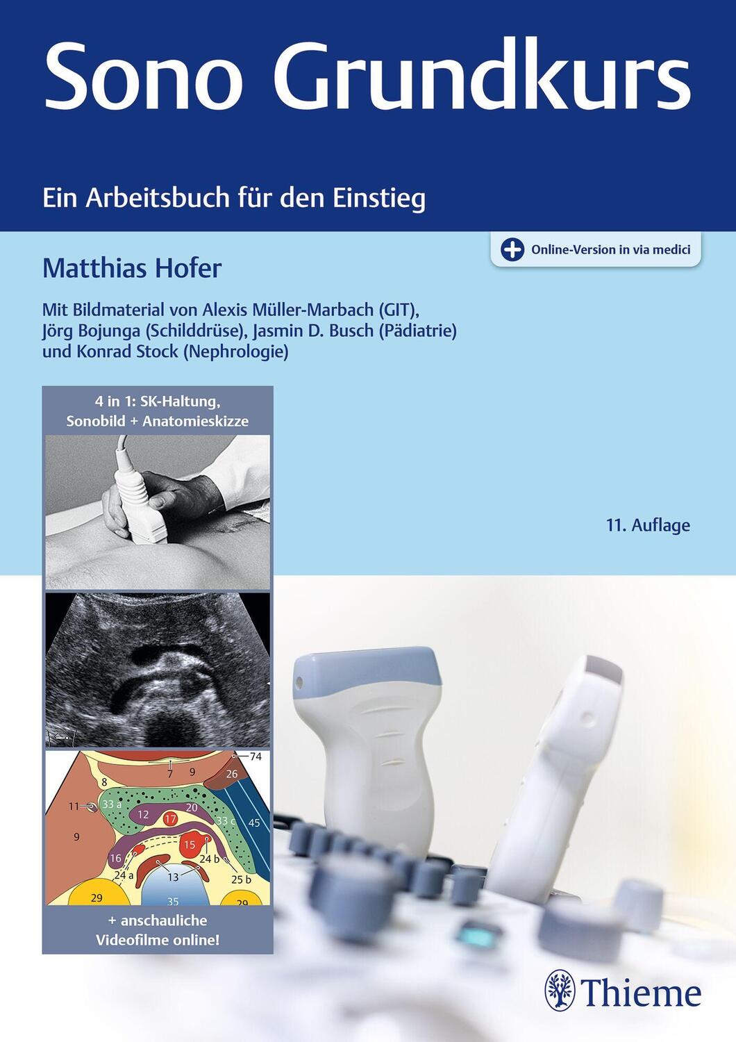 Cover: 9783132452053 | Sono Grundkurs | Ein Arbeitsbuch für den Einstieg | Matthias Hofer