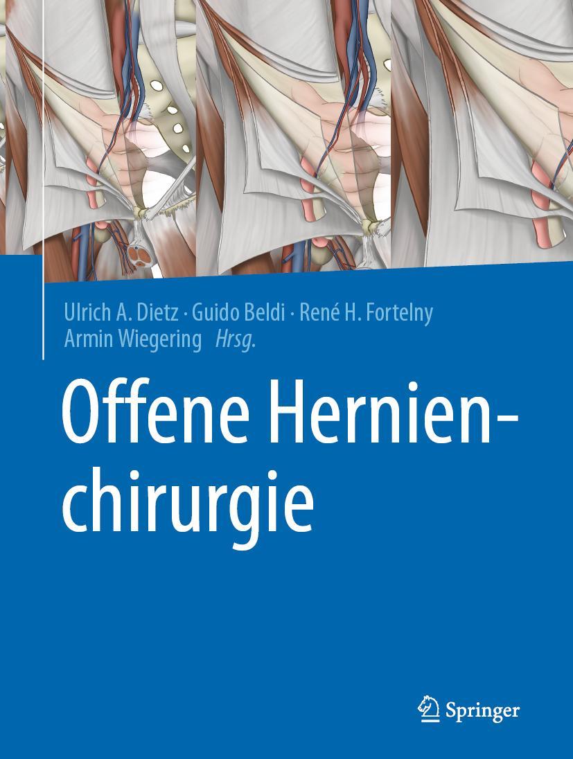 Cover: 9783662613474 | Offene Hernienchirurgie | Ulrich A. Dietz (u. a.) | Buch | xx | 2021