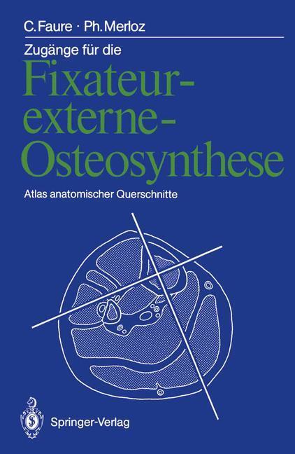 Cover: 9783642726279 | Zugänge für die Fixateur-externe-Osteosynthese | Claude Faure (u. a.)