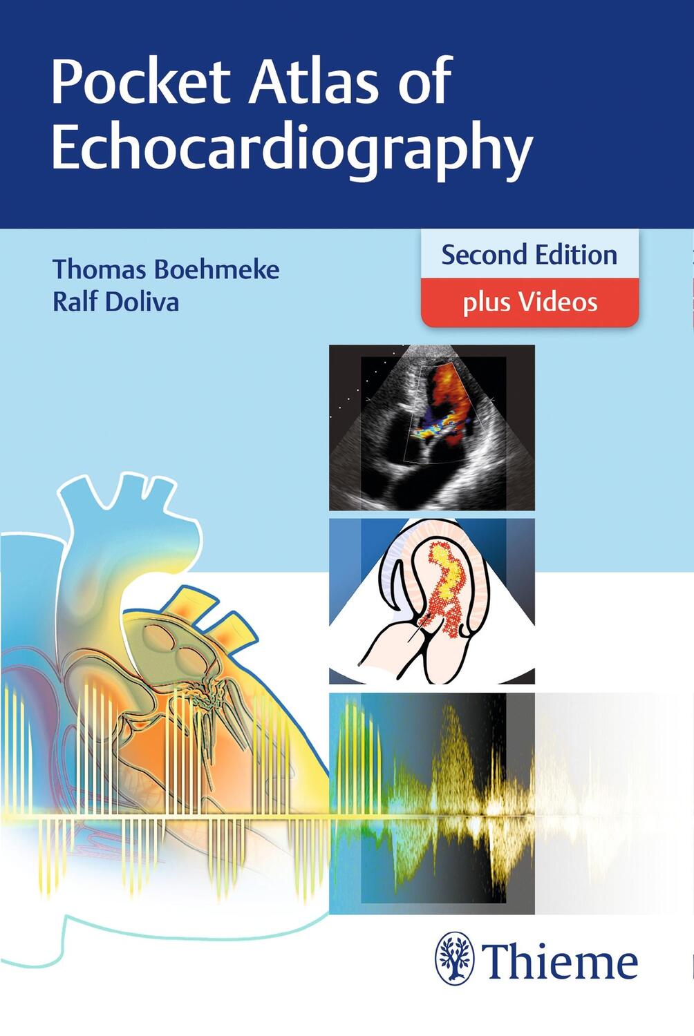 Cover: 9783132417229 | Pocket Atlas of Echocardiography | Thomas Böhmeke (u. a.) | Buch