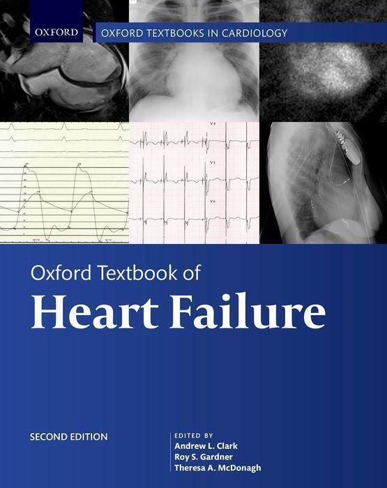 Cover: 9780198766223 | Oxford Textbook of Heart Failure | Andrew L Clark (u. a.) | Buch