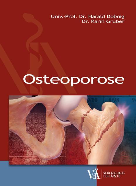 Cover: 9783990521311 | Osteoporose | Harald Dobnig (u. a.) | Taschenbuch | Deutsch | 2016