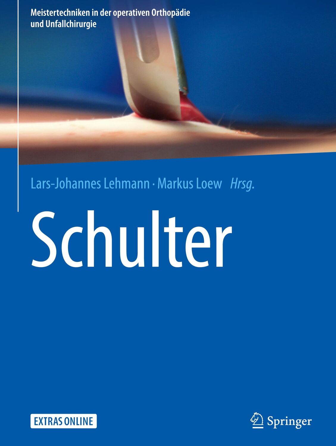 Cover: 9783662547458 | Schulter | Markus Loew (u. a.) | Buch | HC runder Rücken kaschiert