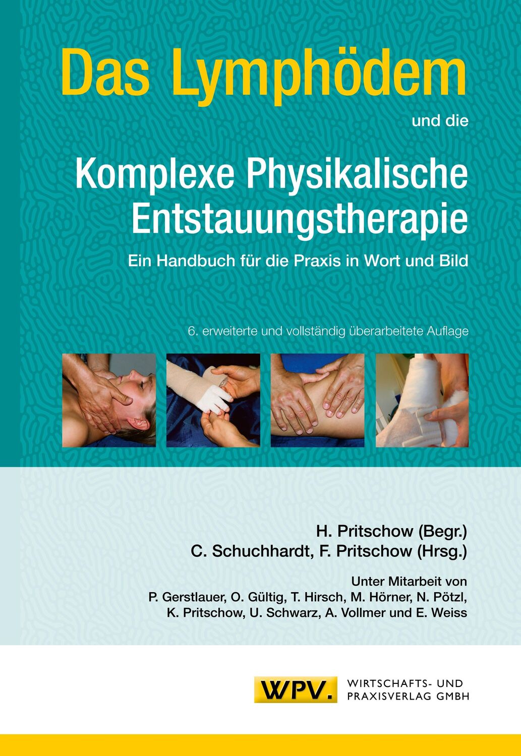 Cover: 9783934371675 | Das Lymphödem und die Komplexe Physikalische Entstauungstherapie | WPV
