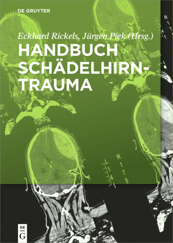 Cover: 9783110372342 | Handbuch Schädelhirntrauma | Eckhard Rickels (u. a.) | Buch | 2018