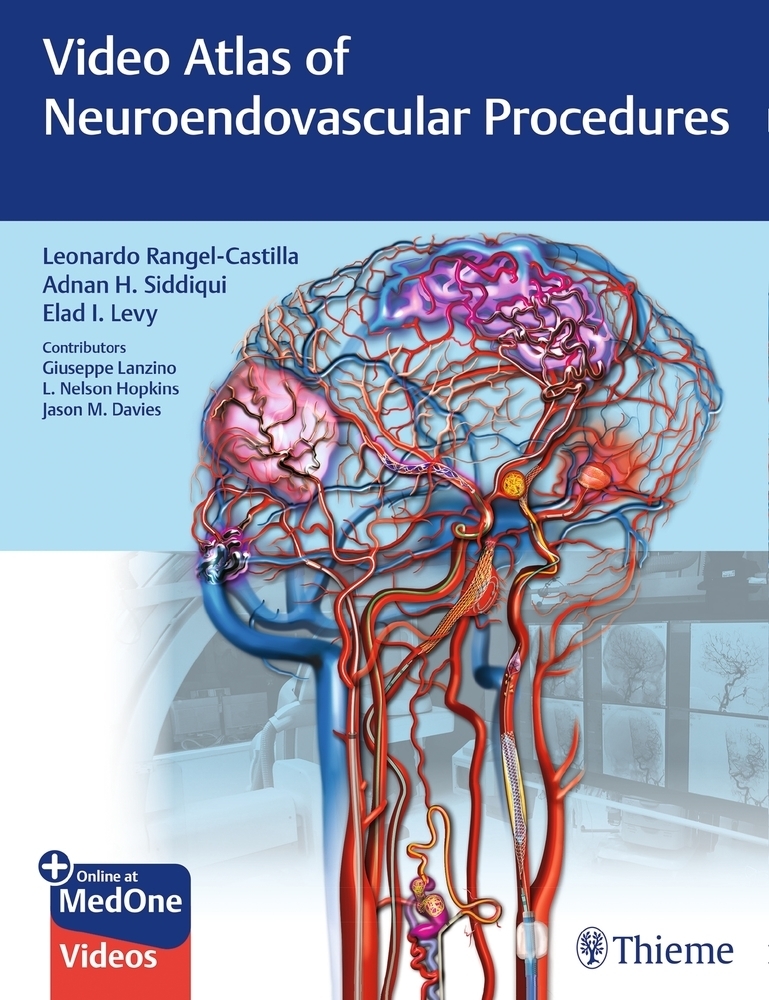 Cover: 9781684201181 | Video Atlas of Neuroendovascular Procedures | Siddiqui (u. a.) | 2020