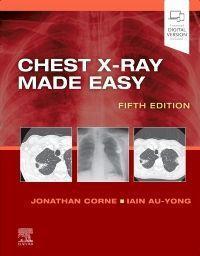 Cover: 9780702082344 | Chest X-Ray Made Easy | Jonathan Corne (u. a.) | Taschenbuch | 2022