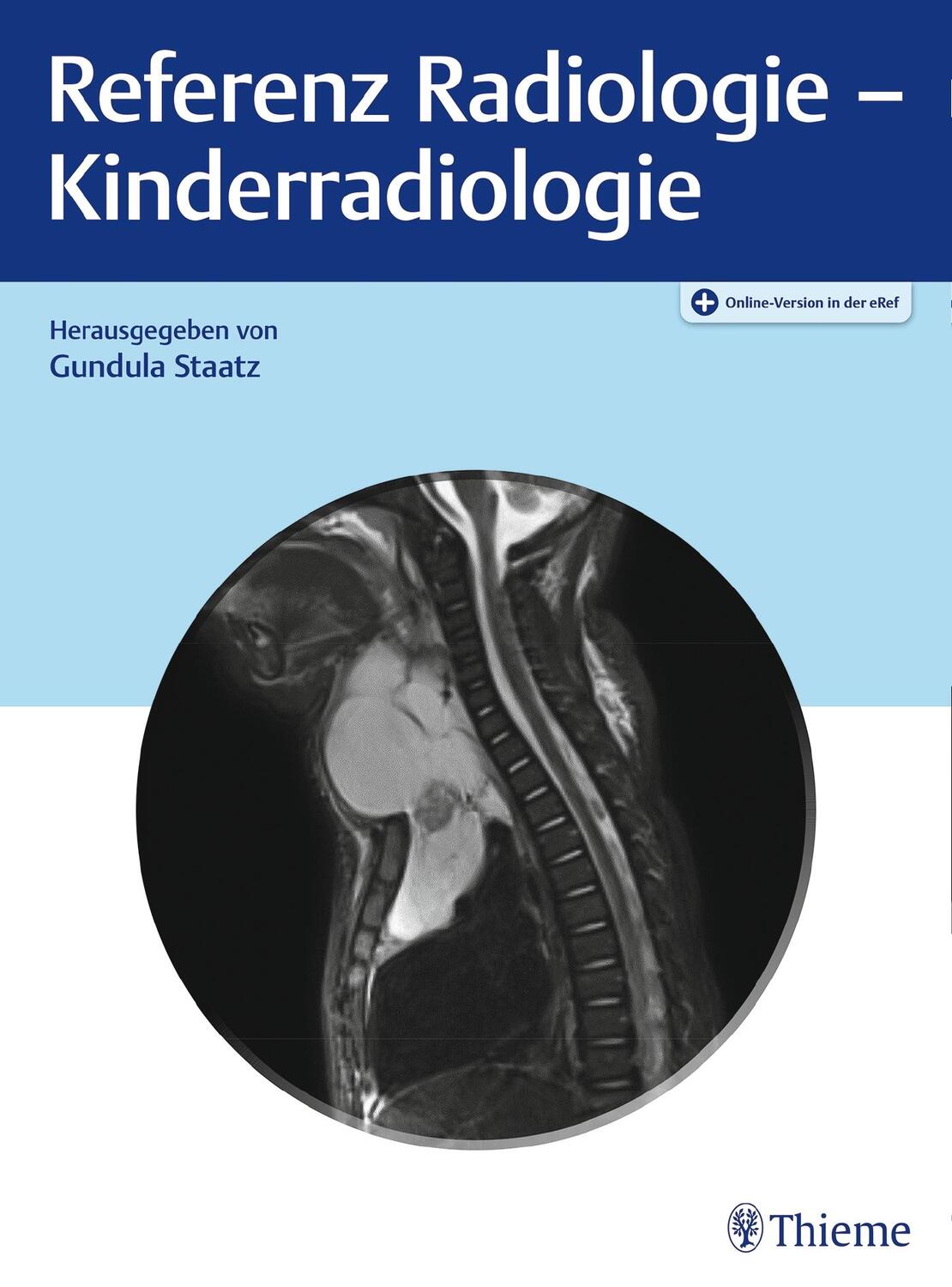 Cover: 9783132418660 | Referenz Radiologie - Kinderradiologie | Gundula Staatz | Bundle
