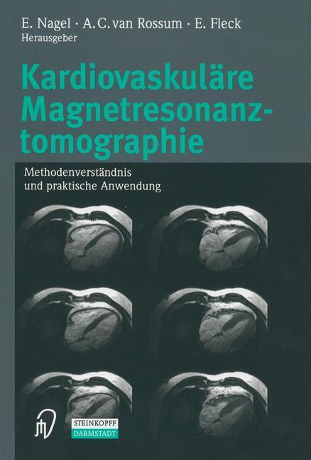 Cover: 9783642632914 | Kardiovaskuläre Magnetresonanztomographie | E. Nagel (u. a.) | Buch