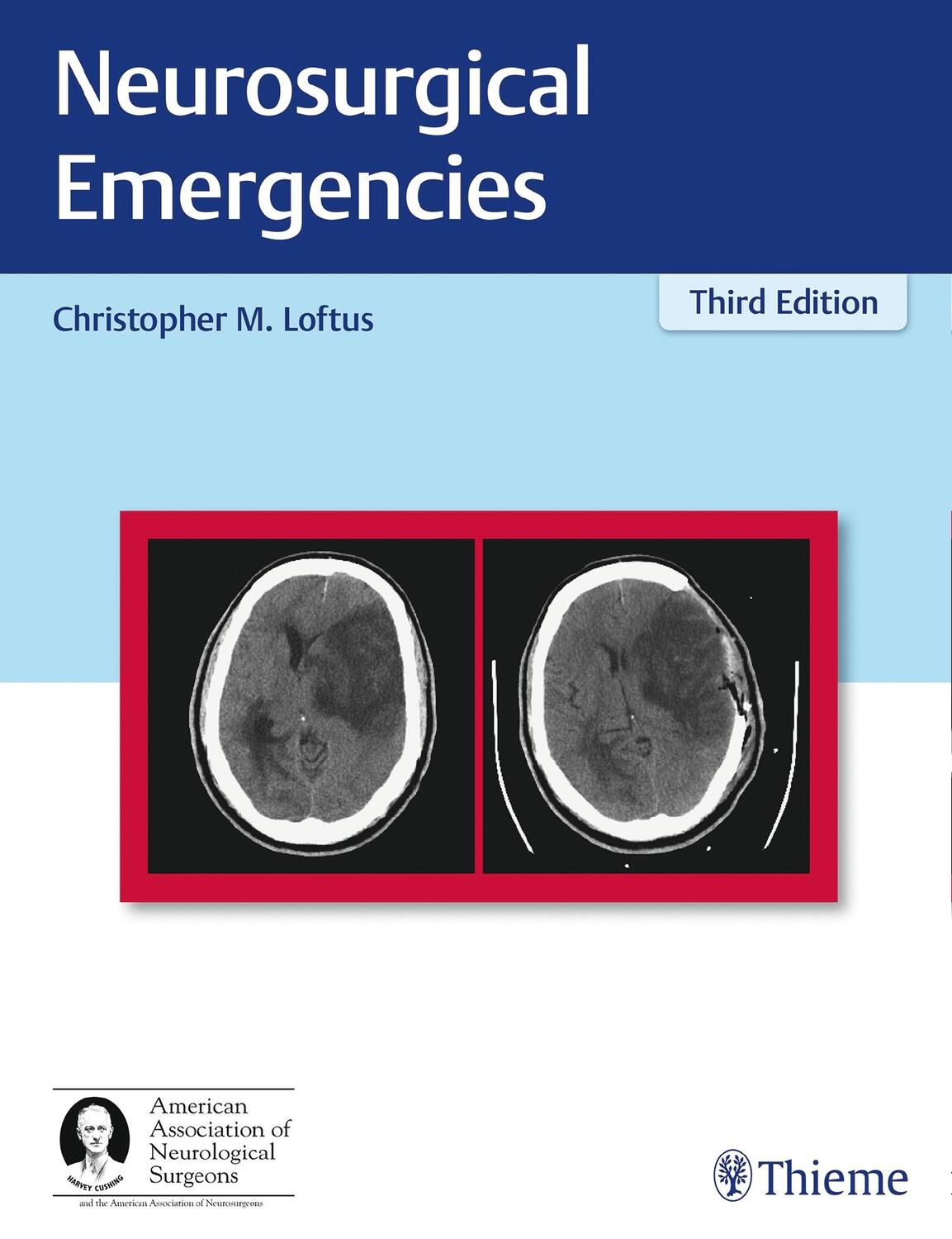 Cover: 9781626233331 | Neurosurgical Emergencies | Christopher Loftus | Buch | Aan | 420 S.