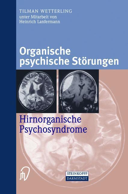 Cover: 9783642632884 | Organische psychische Störungen | Hirnorganische Psychosyndrome | Buch