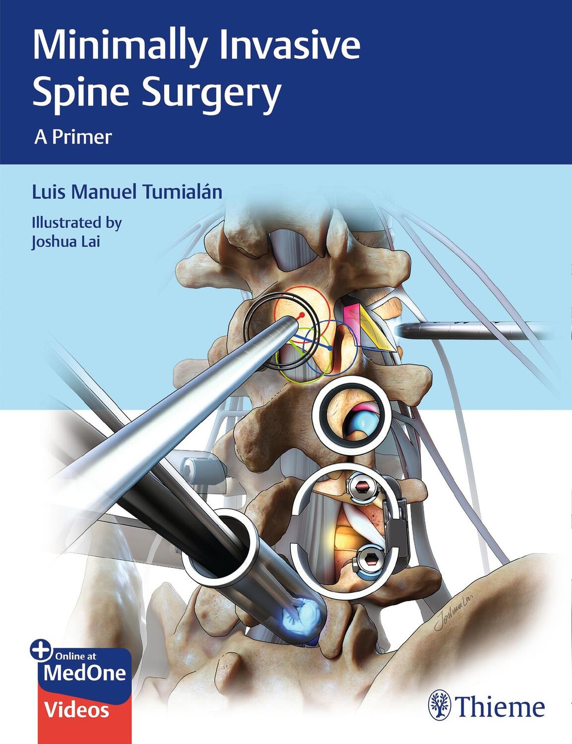 Cover: 9781626232181 | Minimally Invasive Spine Surgery | A Primer | Luis Manuel Tumialan