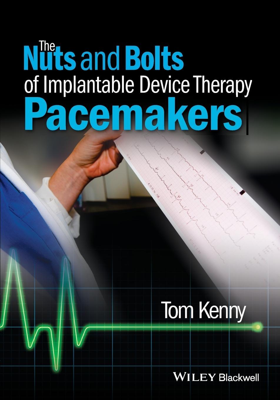 Cover: 9781118670675 | The Nuts and Bolts of Implantable Device Therapy | Pacemakers | Kenny