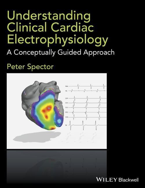 Cover: 9781118905494 | Understanding Clinical Cardiac Electrophysiology | Peter Spector