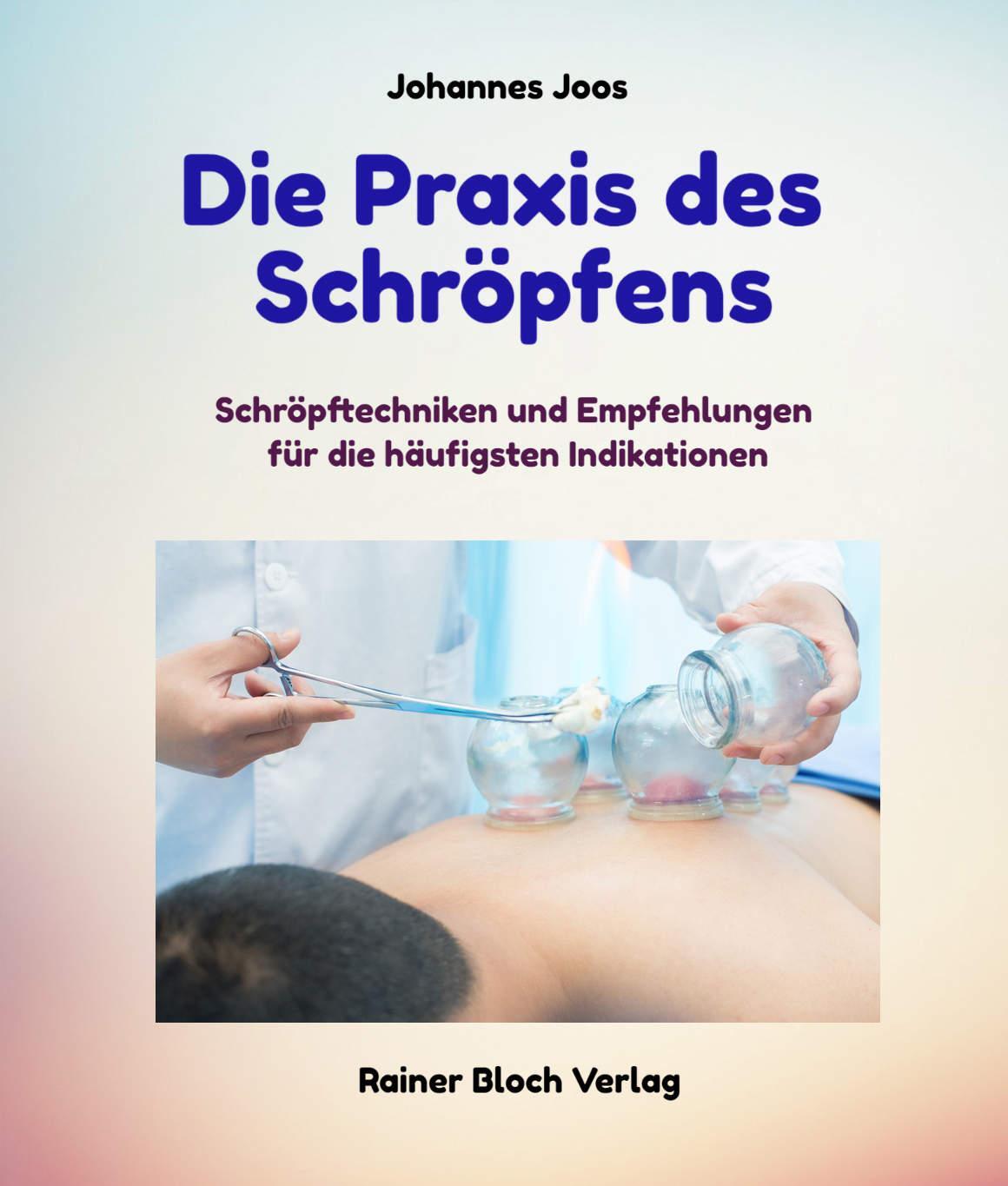 Cover: 9783942179546 | Die Praxis des Schröpfens | Johannes Joos | Taschenbuch | Deutsch