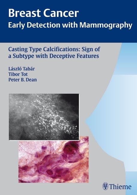 Cover: 9783131353917 | Casting Type Calcifications: Sign of a Subtype with Deceptive Features