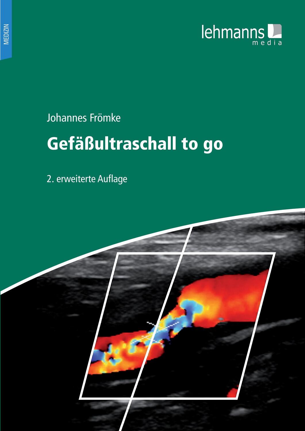 Cover: 9783965433168 | Gefäßultraschall to go | Johnnes Frömke | Taschenbuch | Deutsch | 2022
