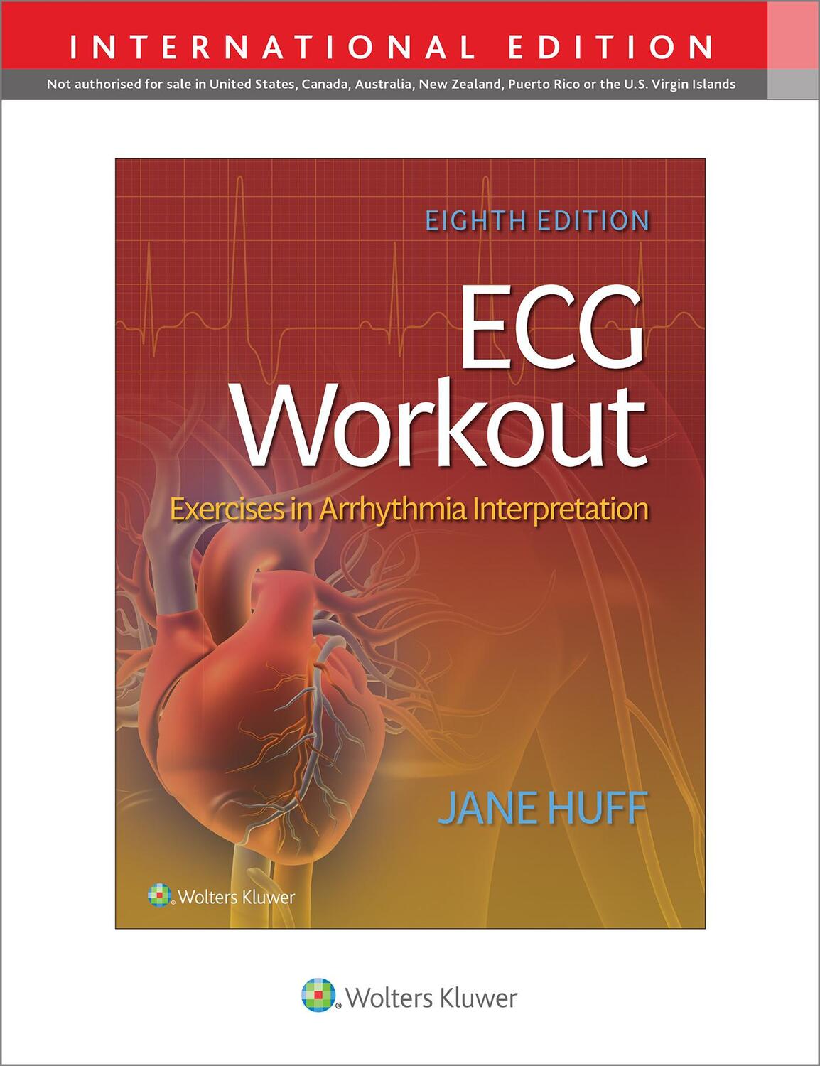 Cover: 9781975174576 | ECG Workout | Exercises in Arrythmia Interpretation | Jane Huff | Buch