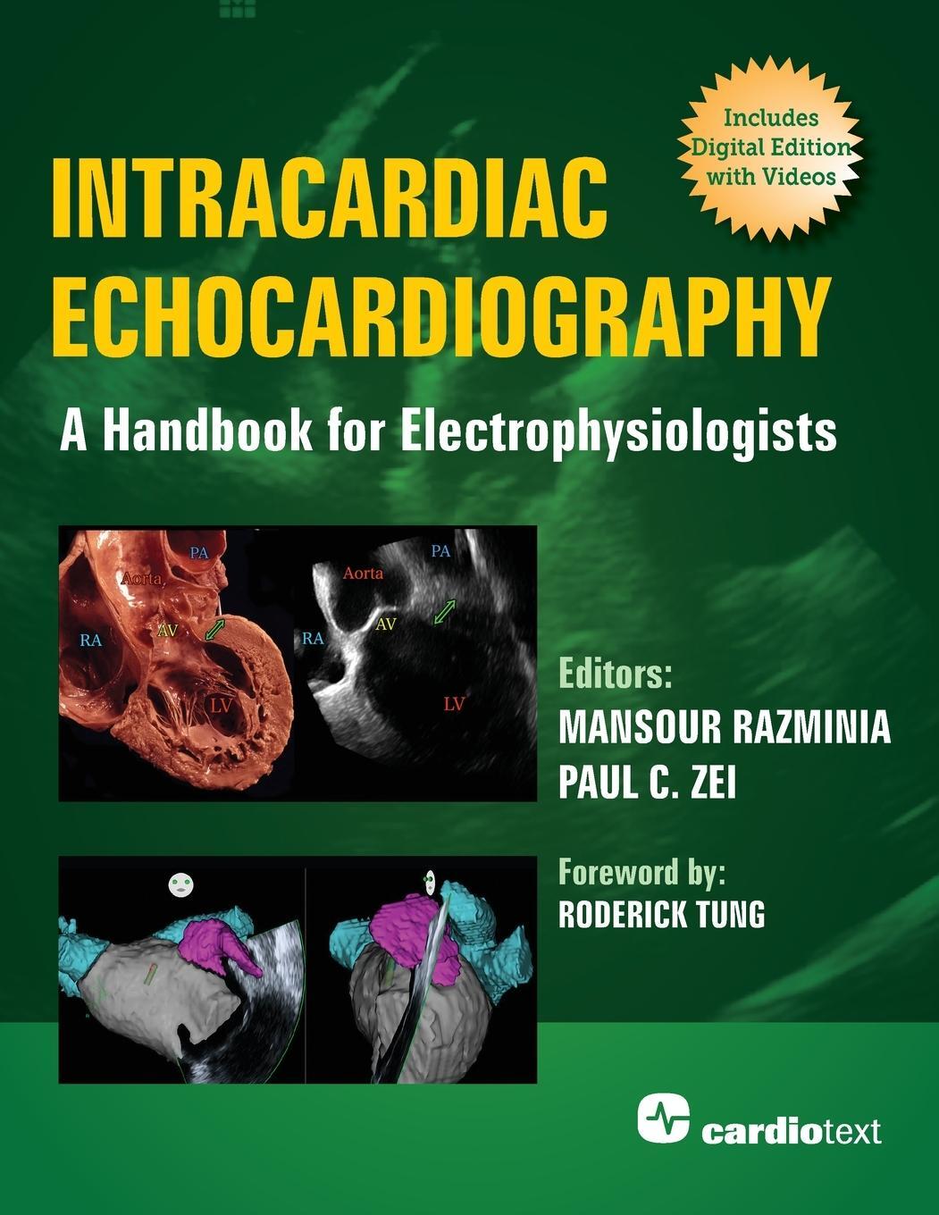 Cover: 9781942909392 | Intracardiac Echocardiography | A Handbook for Electrophysiologists