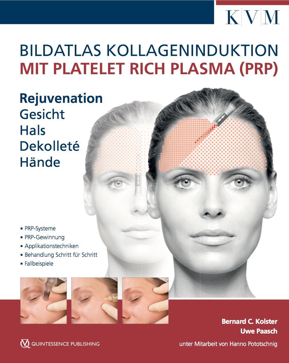 Cover: 9783868673760 | Bildatlas Kollageninduktion mit Platelet Rich Plasma (PRP) | Buch
