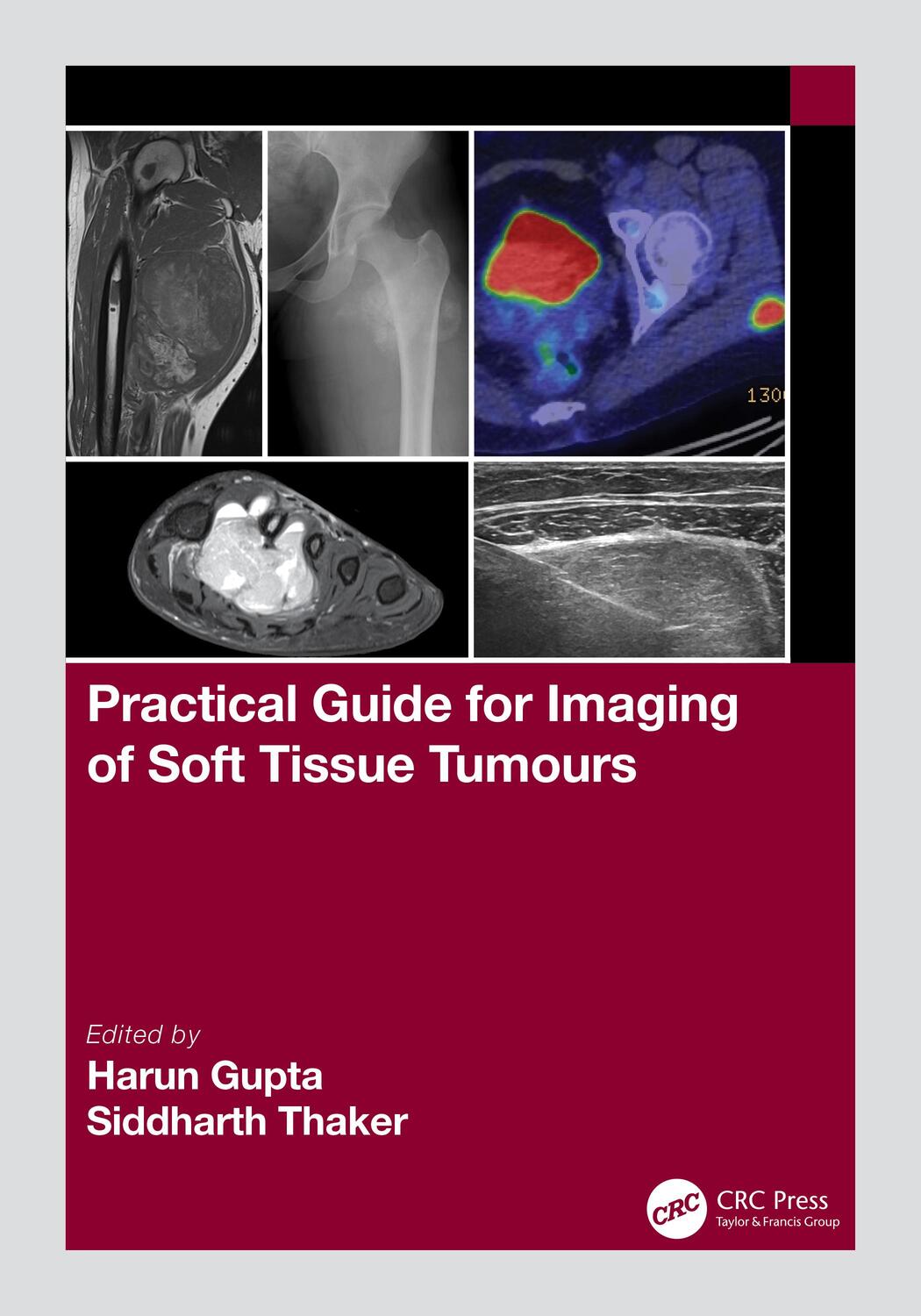 Cover: 9781032111759 | Practical Guide for Imaging of Soft Tissue Tumours | Gupta (u. a.)