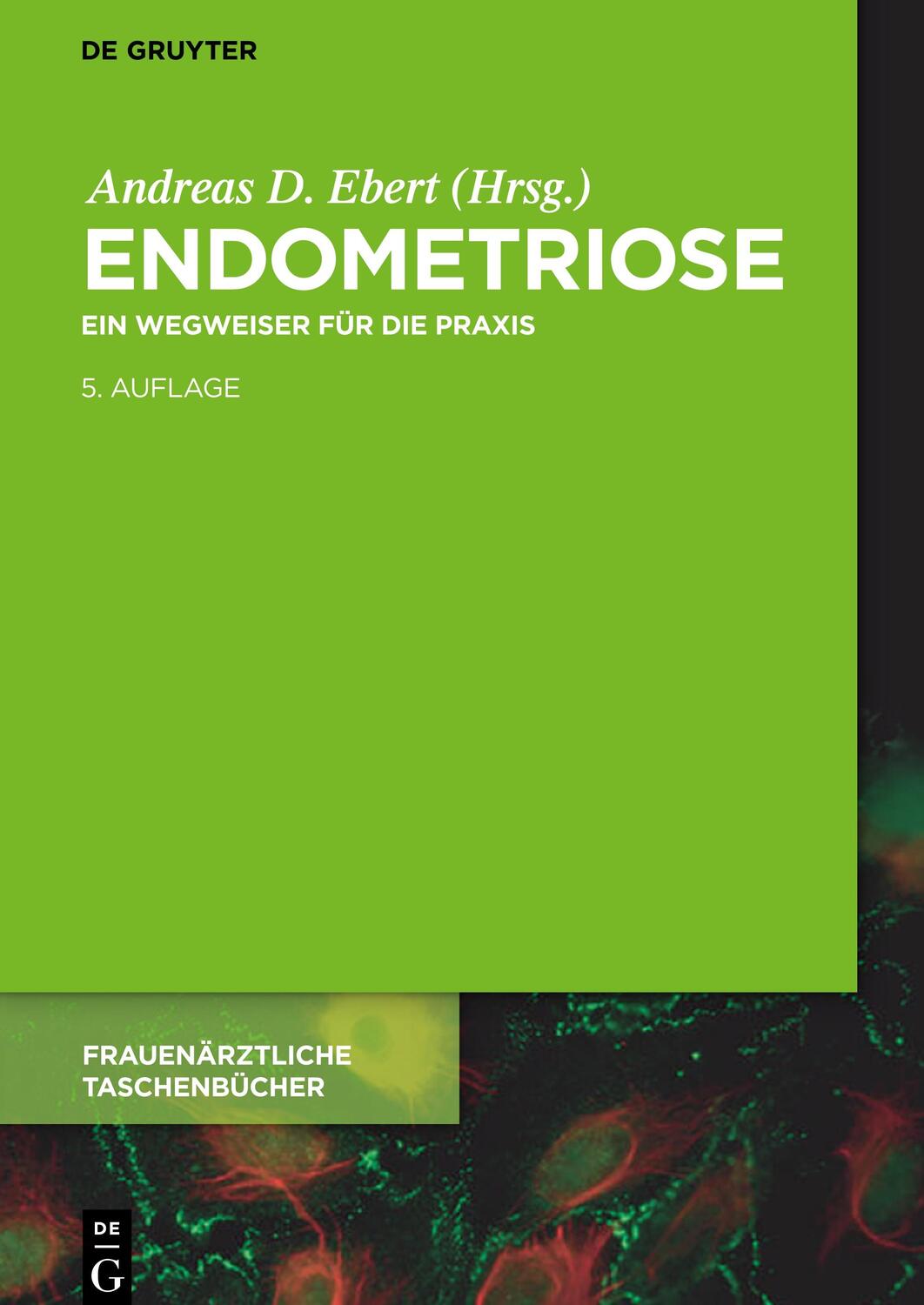 Cover: 9783110559781 | Endometriose | Ein Wegweiser für die Praxis | Andreas D. Ebert | Buch