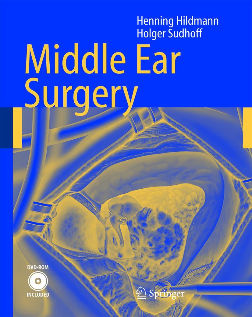 Cover: 9783540222019 | Middle Ear Surgery | Holger Sudhoff (u. a.) | Buch | xv | Englisch