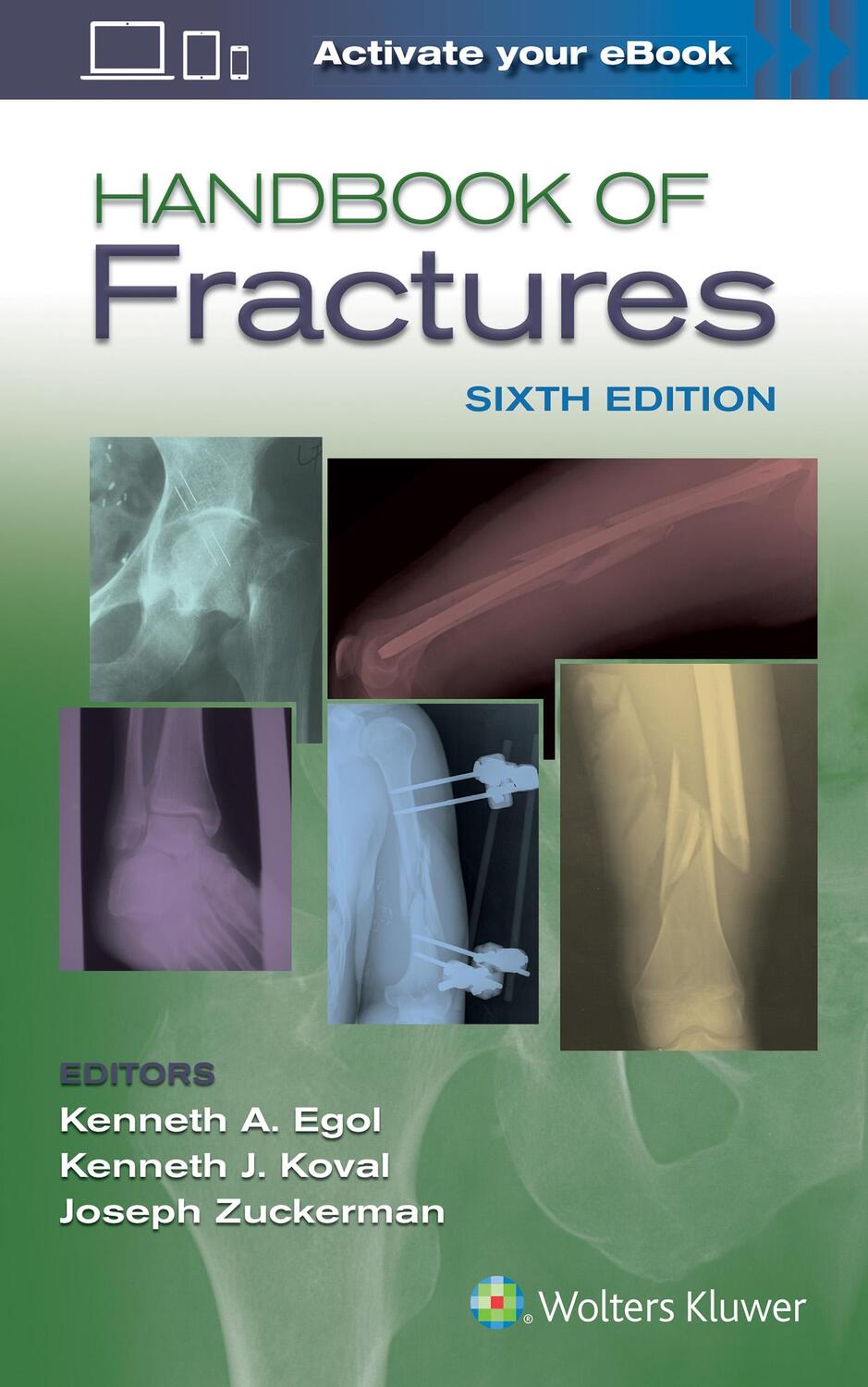 Cover: 9781496384850 | Handbook of Fractures | Egol | Taschenbuch | Englisch | 2019