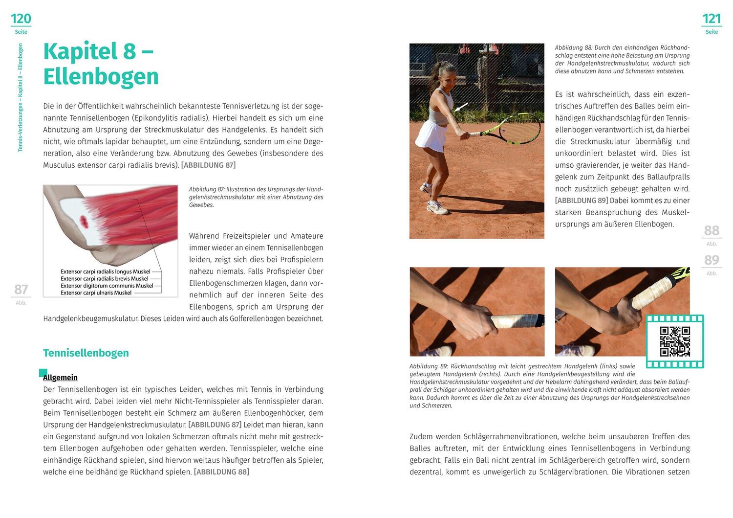 Bild: 9783964160645 | Tennis-Verletzungen | Peter Kaiser | Taschenbuch | Deutsch | 2022
